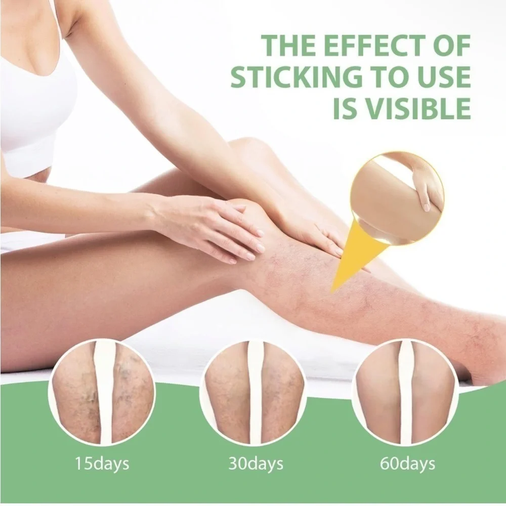 Varicose Veins Cream - Green Nourishing Leg Gel (50g) Lot Of 3 NEW